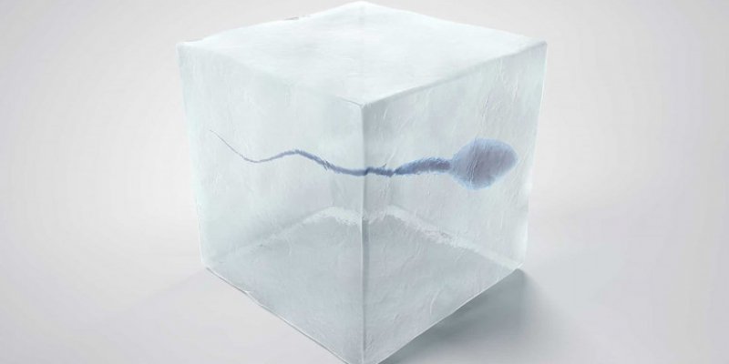 Congelamento de sêmen é opção para homens com câncer preservarem a fertilidade